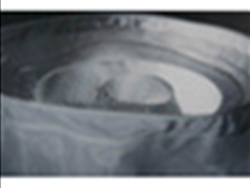 離心機專用濾袋